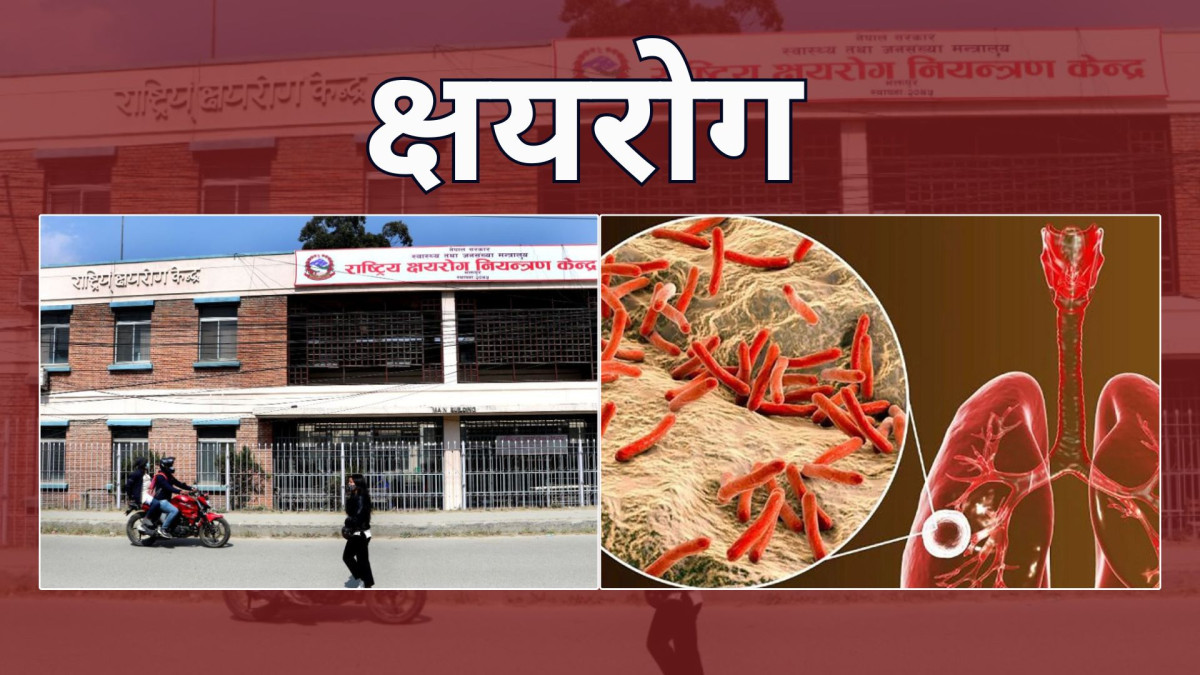 नेपालमा ६८ हजार नयाँ क्षयरोगी, २७ हजार भन्दा बढी छैनन् उपचारको पहुँचमा
